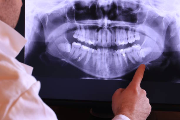 Emergency Dentist for Kids in RI